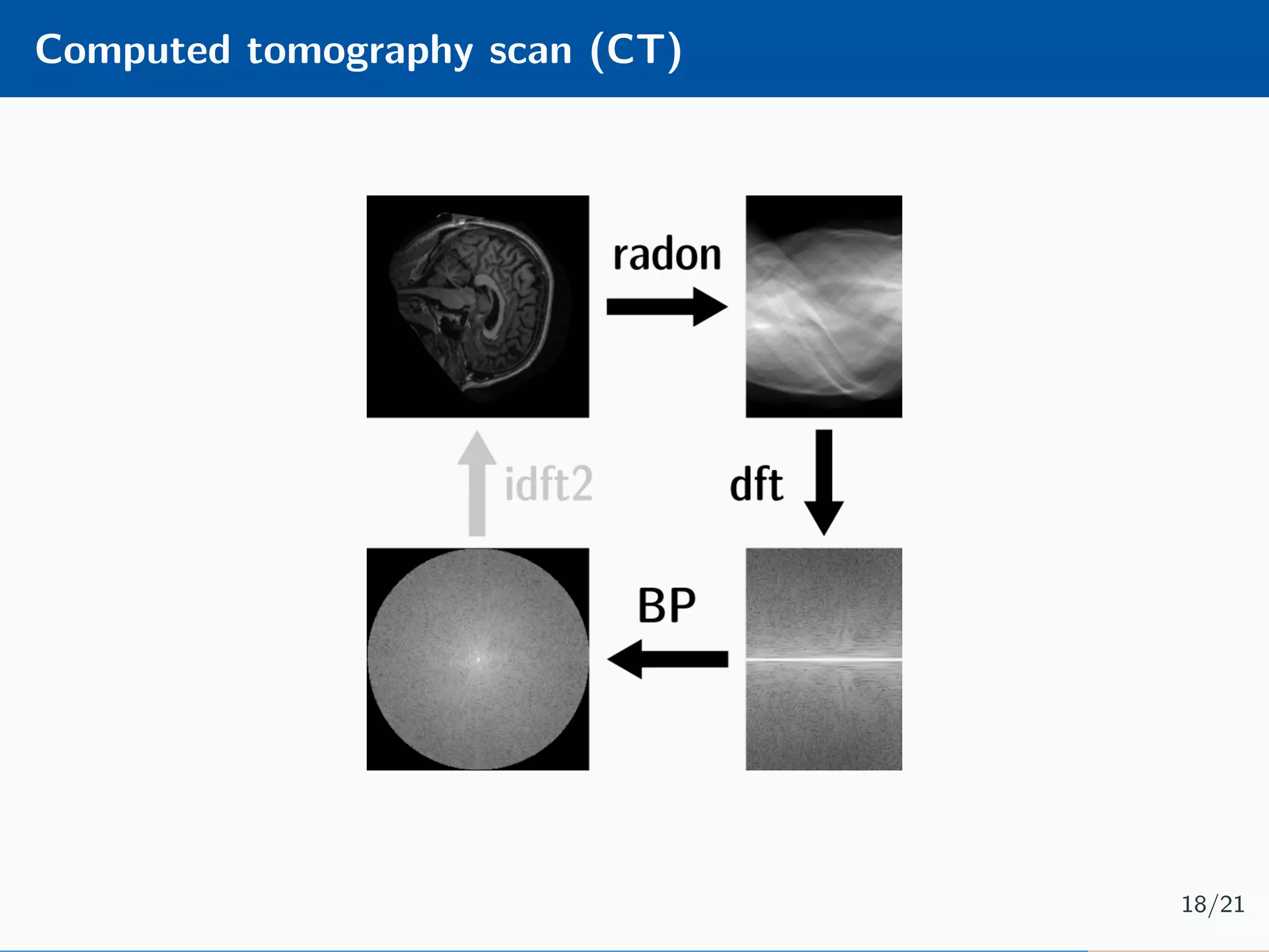 Computed tomography scan (CT) 18/21 