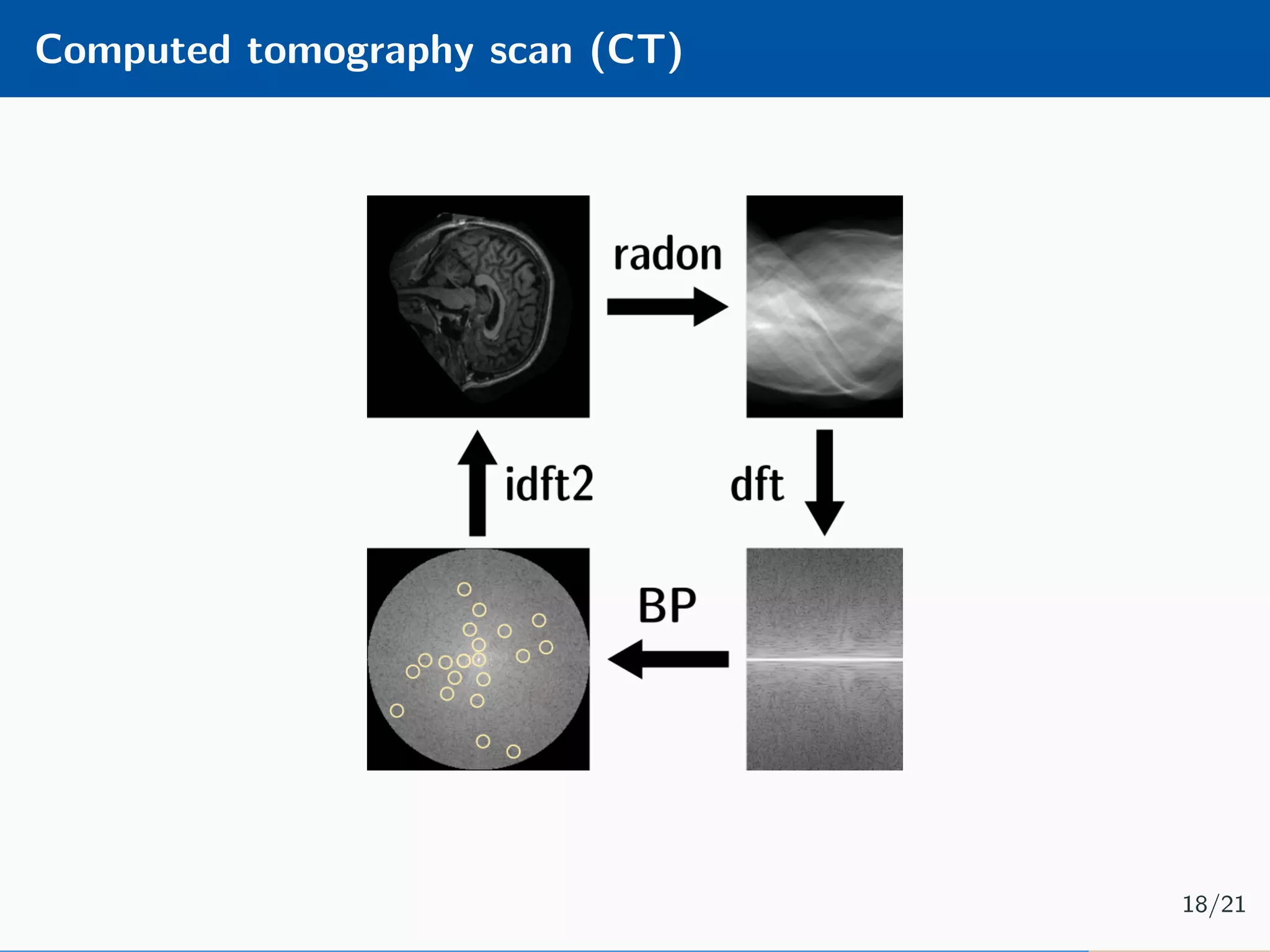 Computed tomography scan (CT) 18/21 