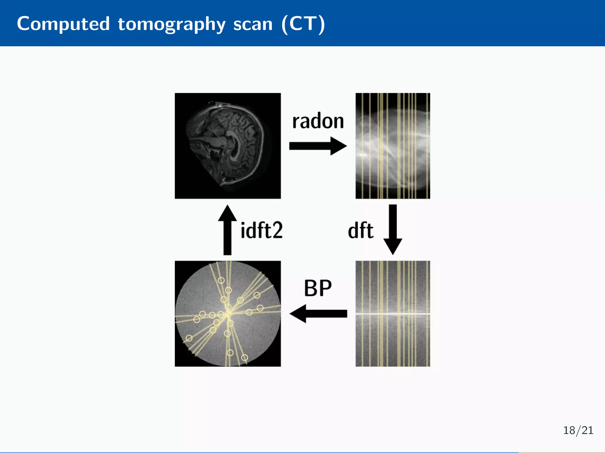 Computed tomography scan (CT) 18/21 