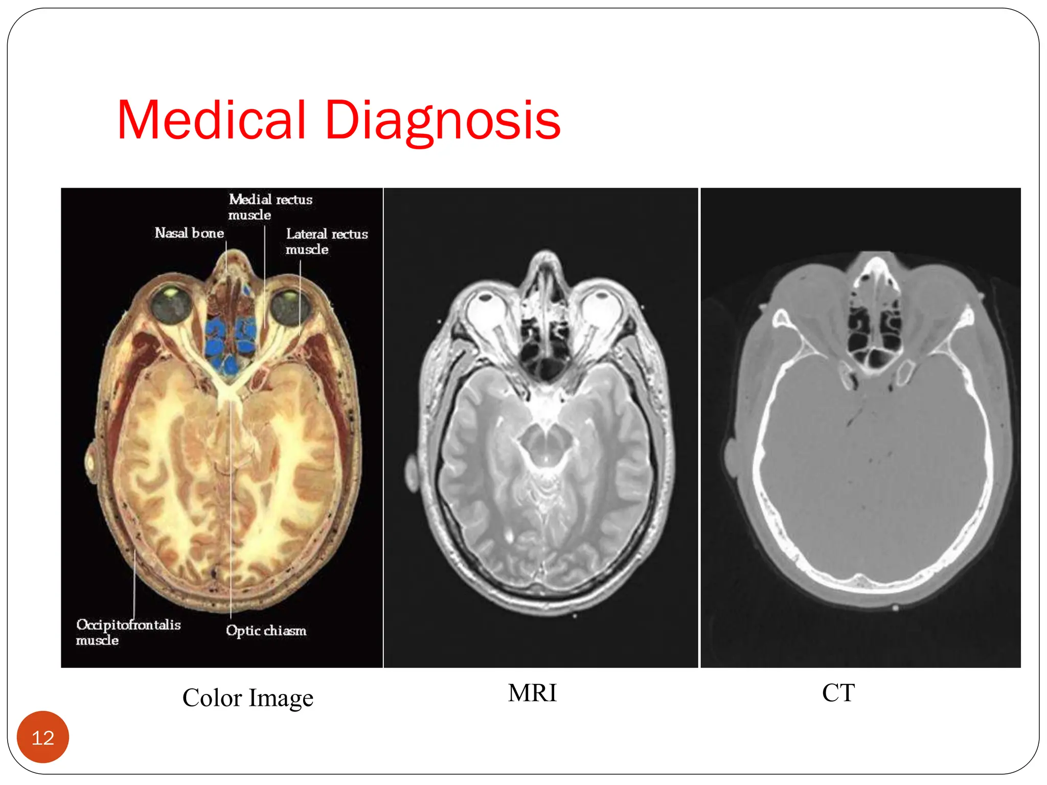 Medical Diagnosis
Color Image MRI CT
12
 