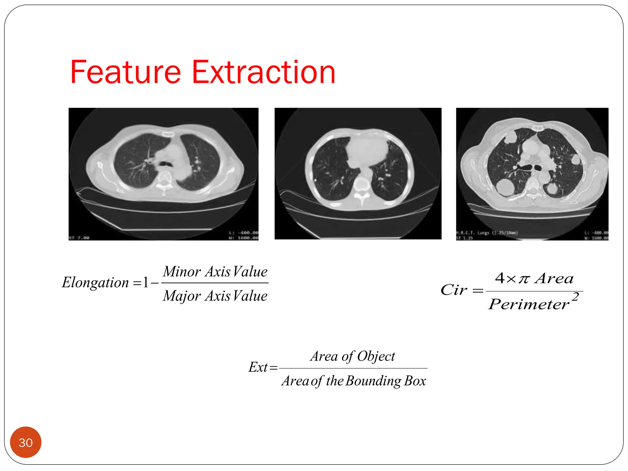 Feature Extraction
1
Minor AxisValue
Elongation
Major AxisValue
  4
2
Area
Cir
Perimeter



Area of Object
Ext
Areaof theBounding Box

30
 