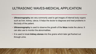 ULTRASONIC WAVES-MEDICAL APPLICATION
• Ultrasonography are very commonly used to get images of internal body organs
such as liver, kidney, uterus. It helps the doctor to diagnose and treat problems in
the body of the patient.
• Ultrasonography is used to observe the growth of the fetus inside the uterus. It
can also use to monitor the abnormalities.
• It is used to break kidney stones into fine grains which later get flushed out
through urine.
 