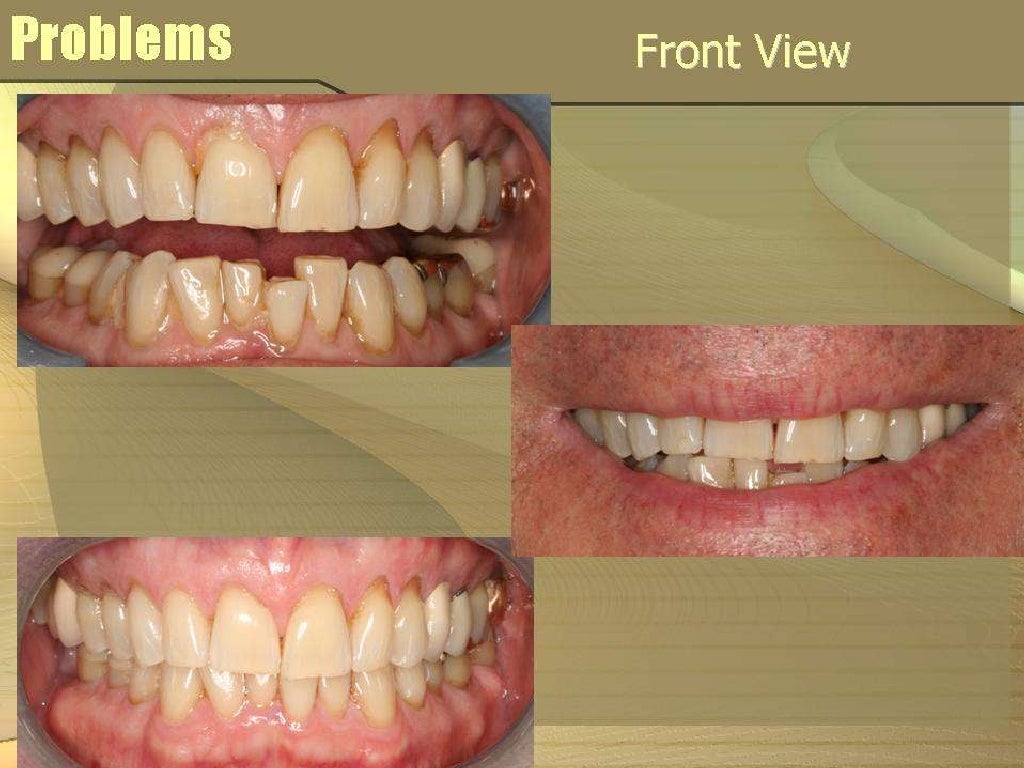 Adlerian therapy case example image