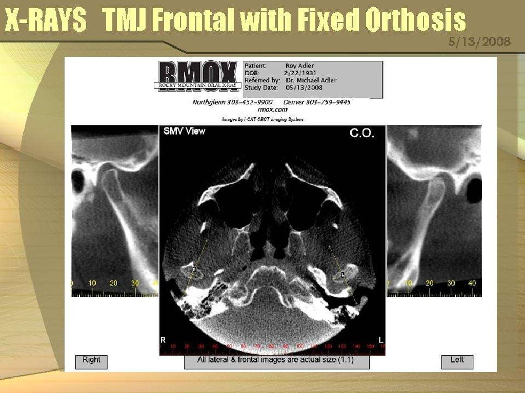 Adlerian therapy case study pdf image