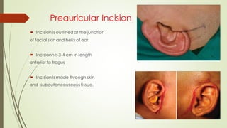 Extraoral Surgical Approaches to Temporomandibular Joint | PDF