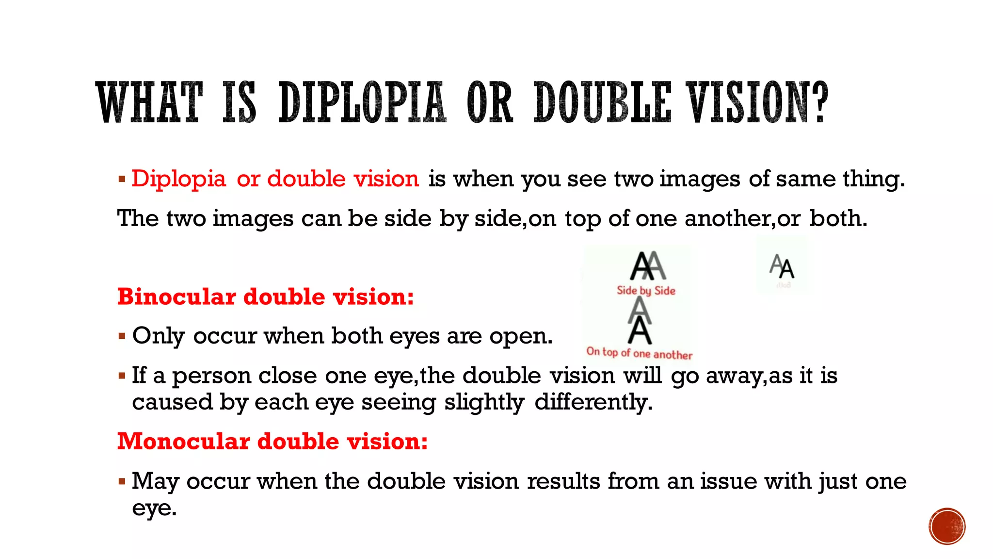 Diplopia charting.pdf