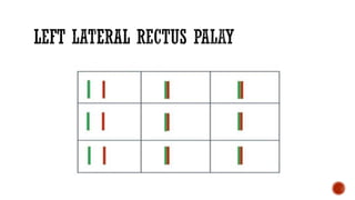 Diplopia Charting Examples Diplopia charting.pdf
