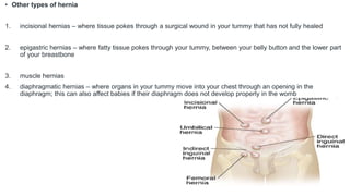 • Other types of hernia
1. incisional hernias – where tissue pokes through a surgical wound in your tummy that has not fully healed
2. epigastric hernias – where fatty tissue pokes through your tummy, between your belly button and the lower part
of your breastbone
3. muscle hernias
4. diaphragmatic hernias – where organs in your tummy move into your chest through an opening in the
diaphragm; this can also affect babies if their diaphragm does not develop properly in the womb
 