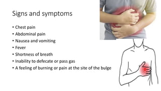 Signs and symptoms
• Chest pain
• Abdominal pain
• Nausea and vomiting
• Fever
• Shortness of breath
• Inability to defecate or pass gas
• A feeling of burning or pain at the site of the bulge
 