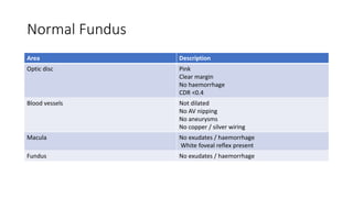 Normal Fundus
Area Description
Optic disc Pink
Clear margin
No haemorrhage
CDR <0.4
Blood vessels Not dilated
No AV nipping
No aneurysms
No copper / silver wiring
Macula No exudates / haemorrhage
White foveal reflex present
Fundus No exudates / haemorrhage
 