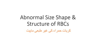 Abnormal Size Shape &
Structure of RBCs
‫کریات‬
‫حمراء‬
‫کی‬
‫غیر‬
‫طبعی‬
‫ماہیت‬
 