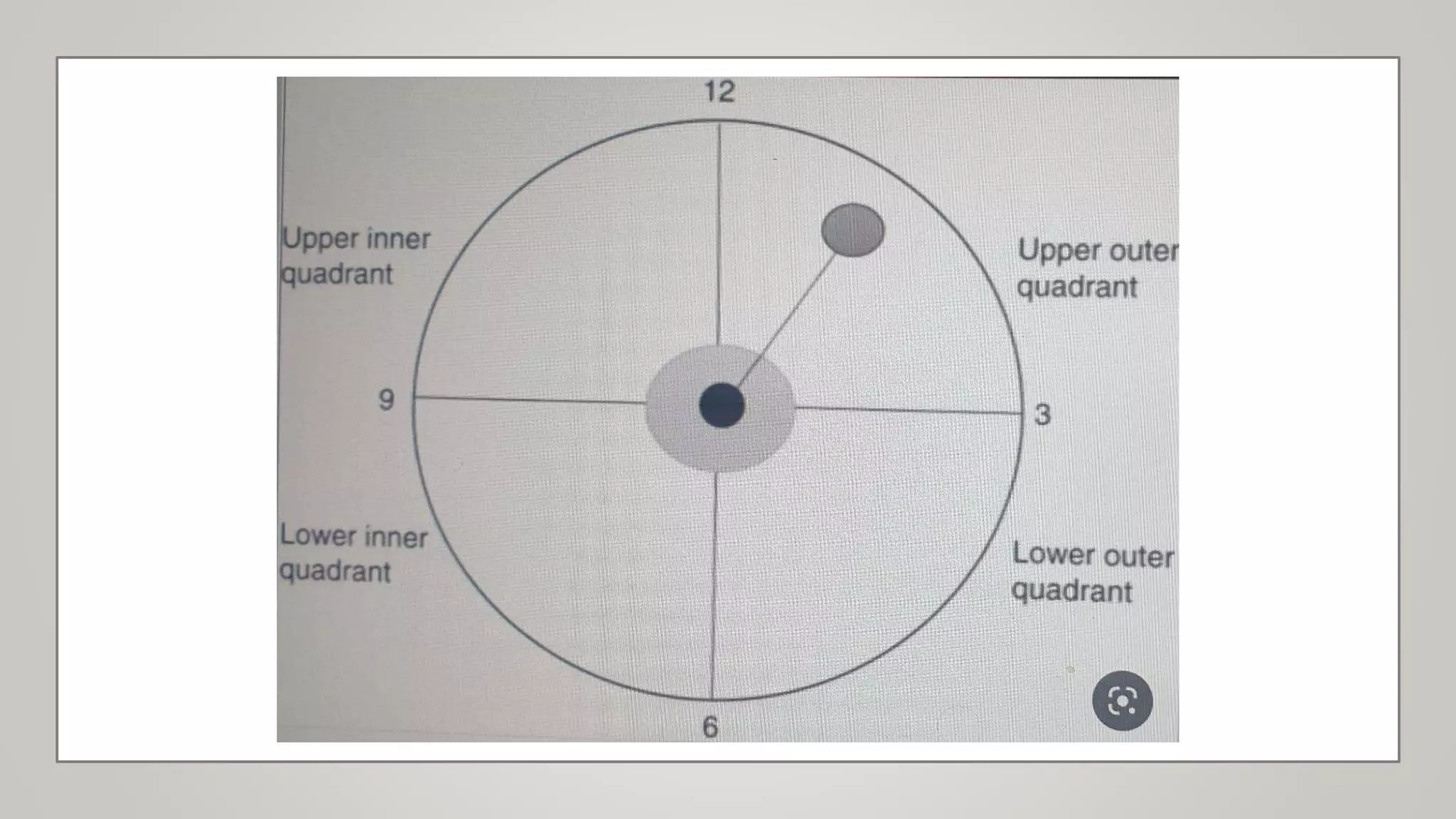 Left Rbeast Quadrants Surgical anatomy of the breast.pptx