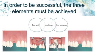 In order to be successful, the three
elements must be achieved
 