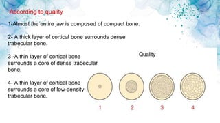 According to quality
1-Almost the entire jaw is composed of compact bone.
2- A thick layer of cortical bone surrounds dense
trabecular bone.
3 -A thin layer of cortical bone
surrounds a core of dense trabecular
bone.
4- A thin layer of cortical bone
surrounds a core of low-density
trabecular bone.
 