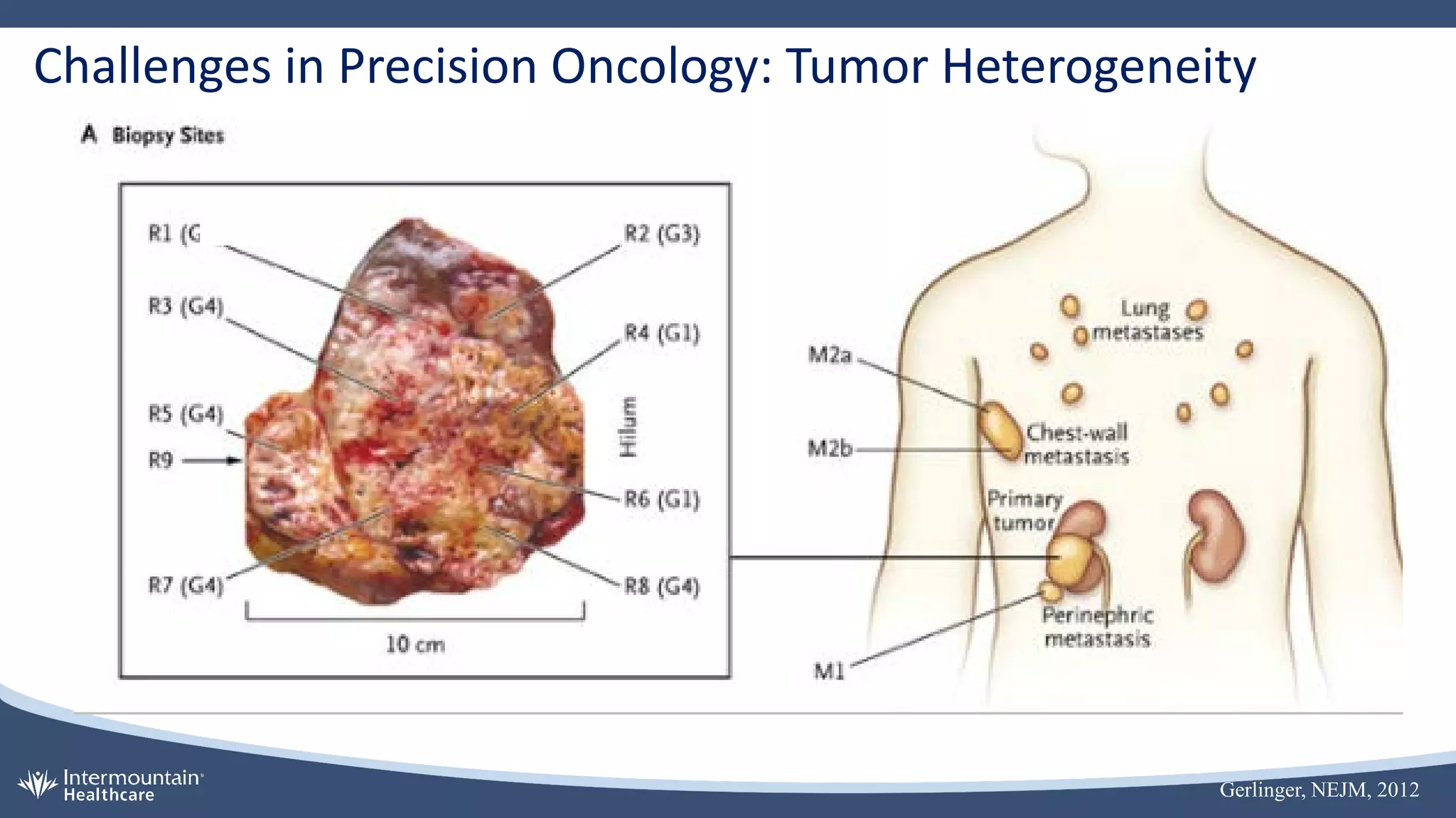 Challenges in Precision Oncology: Tumor Heterogeneity
Gerlinger, NEJM, 2012
 