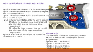 CRANIPHARYNGIOMA –.pptx