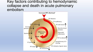 Diagnosis and management of Pulmonary embolism.pptx