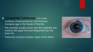 Disease of eyelid ,Anatomy and physiology of eyelid | PPTX