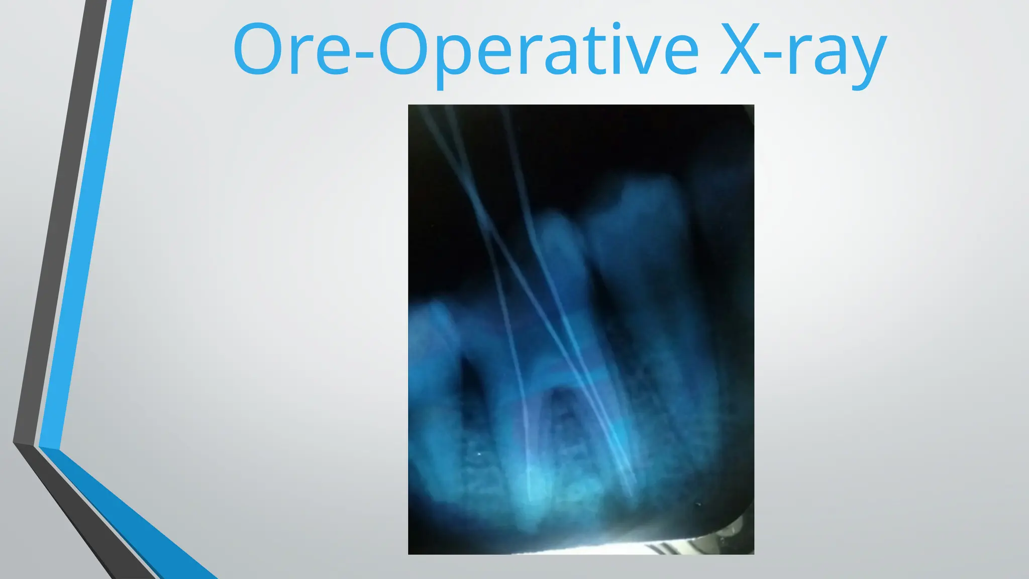 Ore-Operative X-ray