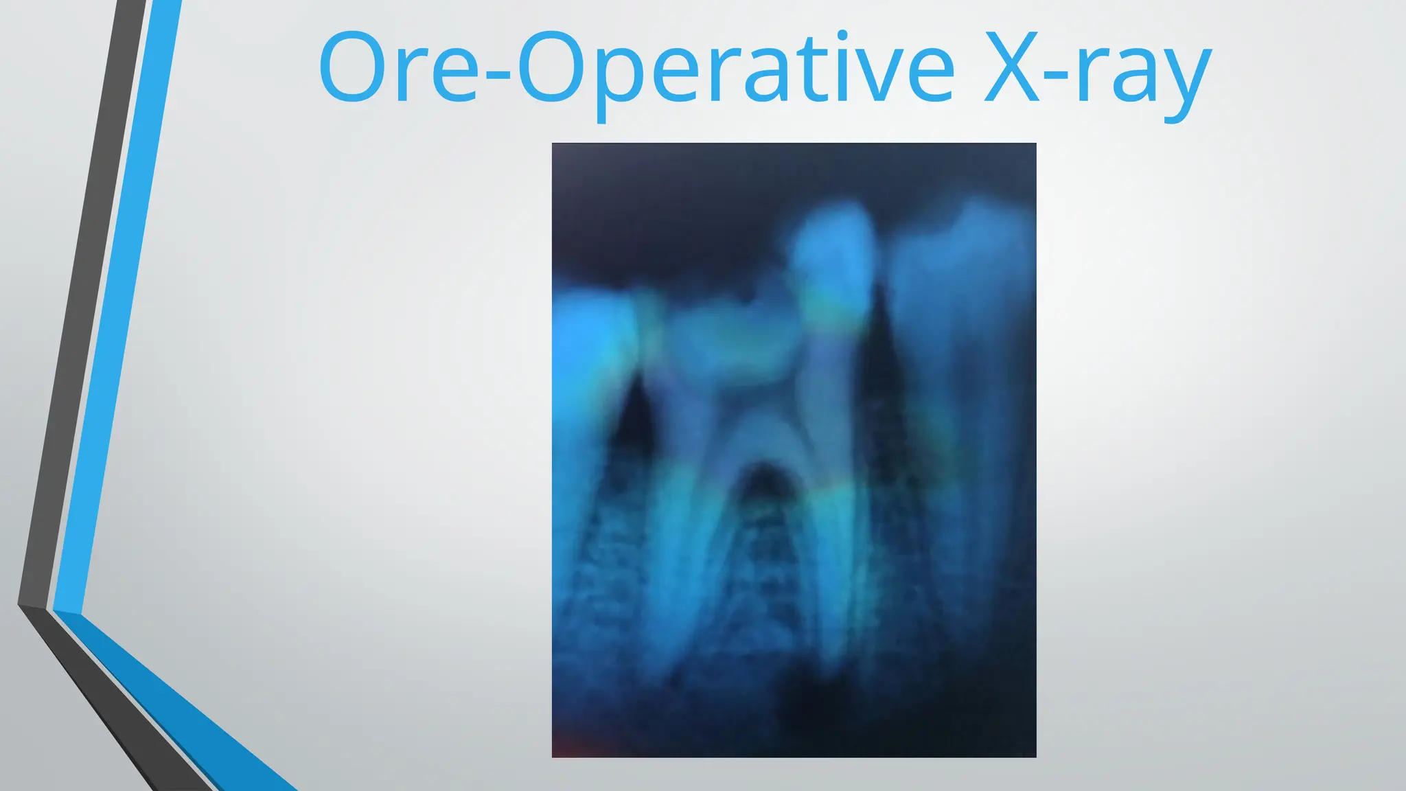 Ore-Operative X-ray