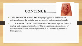 Malpresentation ( sub :- obstetrics and gynaecology) | PPTX
