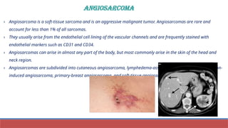 SOFT TISSUE TUMORS CYTOLOGY/PPTX/HEALTHCARE/PATHOLOGY | PPTX