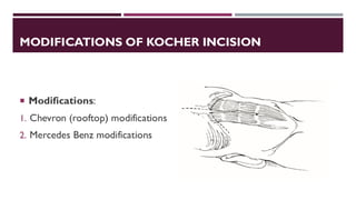 Chevron Invision Urological Incisions Complete Overview Presentation | PDF