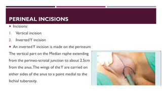 Urological Incisions Complete Overview Presentation | PDF