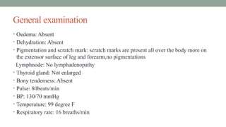 General examination
• Oedema: Absent
• Dehydration: Absent
• Pigmentation and scratch mark: scratch marks are present all over the body more on
the extensor surface of leg and forearm,no pigmentations
Lymphnode: No lymphadenopathy
• Thyroid gland: Not enlarged
• Bony tenderness: Absent
• Pulse: 80beats/min
• BP: 130/70 mmHg
• Temperature: 99 degree F
• Respiratory rate: 16 breaths/min
 