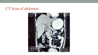 CT Scan of abdomen
 
