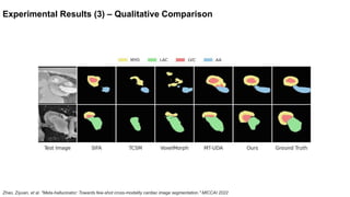 [MICCAI 2022] Meta-hallucinator: Towards Few-Shot Cross-Modality ...