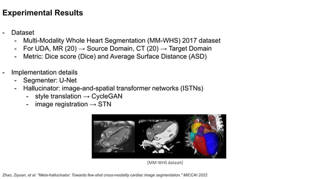 [MICCAI 2022] Meta-hallucinator: Towards Few-Shot Cross-Modality ...