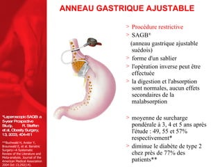 ANNEAU GASTRIQUE AJUSTABLE Procédure restrictive SAGB ®  (anneau gastrique ajustable suédois) forme d'un sablier l'opération inverse peut être effectuée la digestion et l'absorption sont normales, aucun effets secondaires de la malabsorption moyenne de surcharge pondérale à 3, 4 et 5 ans après l'étude :   49, 55 et 57% respectivement* diminue le diabète de type 2 chez près de 77% des patients** *Laparoscopic SAGB: a 5-year Prospective Study,  R. Steffen et al, Obesity Surgery, 13, 2003, 404-411 **Buchwald H, Avidor Y, Braunwald E, et al. Bariatric Surgery—A Systematic Review of the Literature and Meta-analysis. Journal of the American Medical Association 2004 Oct 13;292(14). 