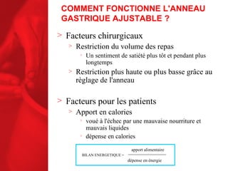 COMMENT FONCTIONNE L'ANNEAU GASTRIQUE AJUSTABLE ? Facteurs chirurgicaux Restriction du volume des repas Un sentiment de satiété plus tôt et pendant plus longtemps Restriction plus haute ou plus basse grâce au règlage de l'anneau Facteurs pour les patients Apport en calories voué à l'échec par une mauvaise nourriture et mauvais liquides dépense en calories BILAN ENERGETIQUE = apport alimentaire dépense en énergie 
