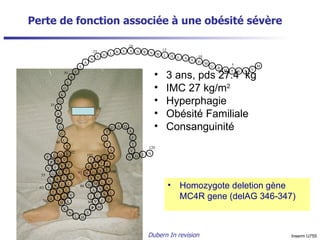 Perte de fonction associée à une obésité sévère 3 ans, pds 27.4  kg IMC 27 kg/m 2 Hyperphagie Obésité Familiale Consanguinité Homozygote deletion gène MC4R gene (delAG 346-347) Dubern In revision  Inserm U755 E V F V T L G V I S L L E N I L V I V A I A N K N L S C I L L T I I I T E S G N S V S V L M D A V A F F Y D N L N H S P M S T T V N I P N S V F L E A S H L R Y S S Q H L W N R G M H T S L V N S T H R M K G G L S E S C Y G G D S Y D S T F Q A D 5 10 15 20 25 120 70 63 42 80 90 97 105 55 30 35 40 K 100 