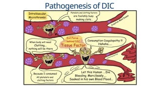 Presentation - Disseminated Intravascular Coagulation.pptx