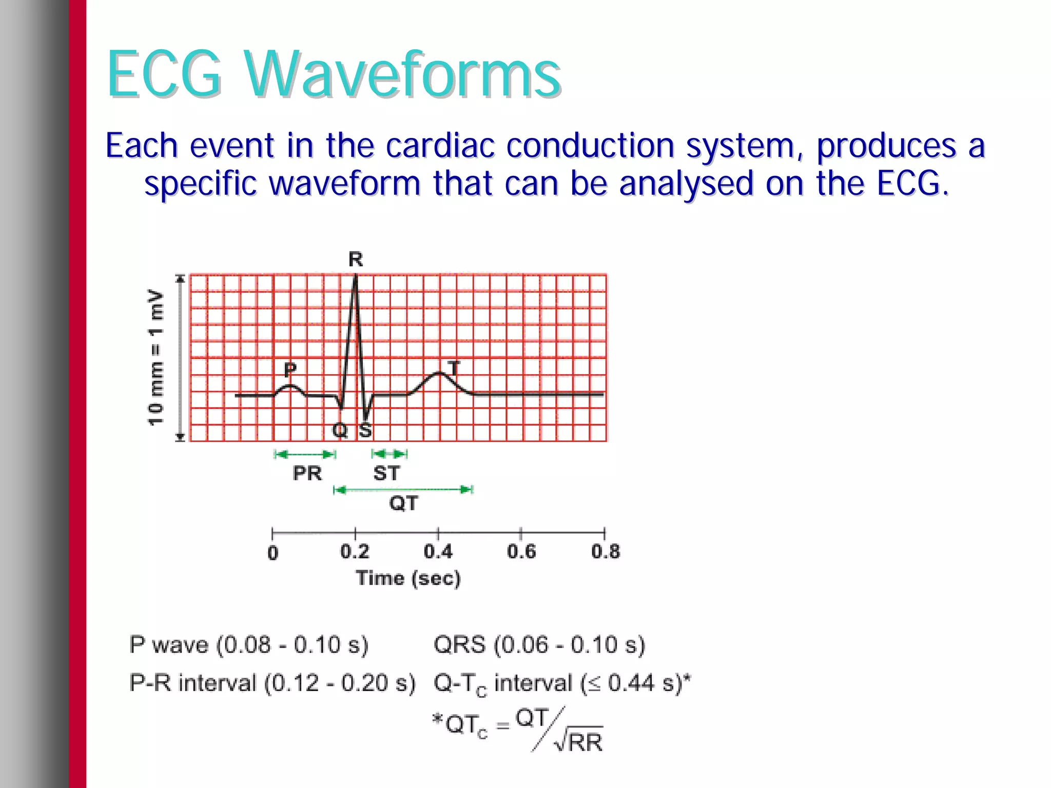 ECG Waveforms
Each event in the cardiac conduction system, produces a
  specific waveform that can be analysed on the ECG.
 
