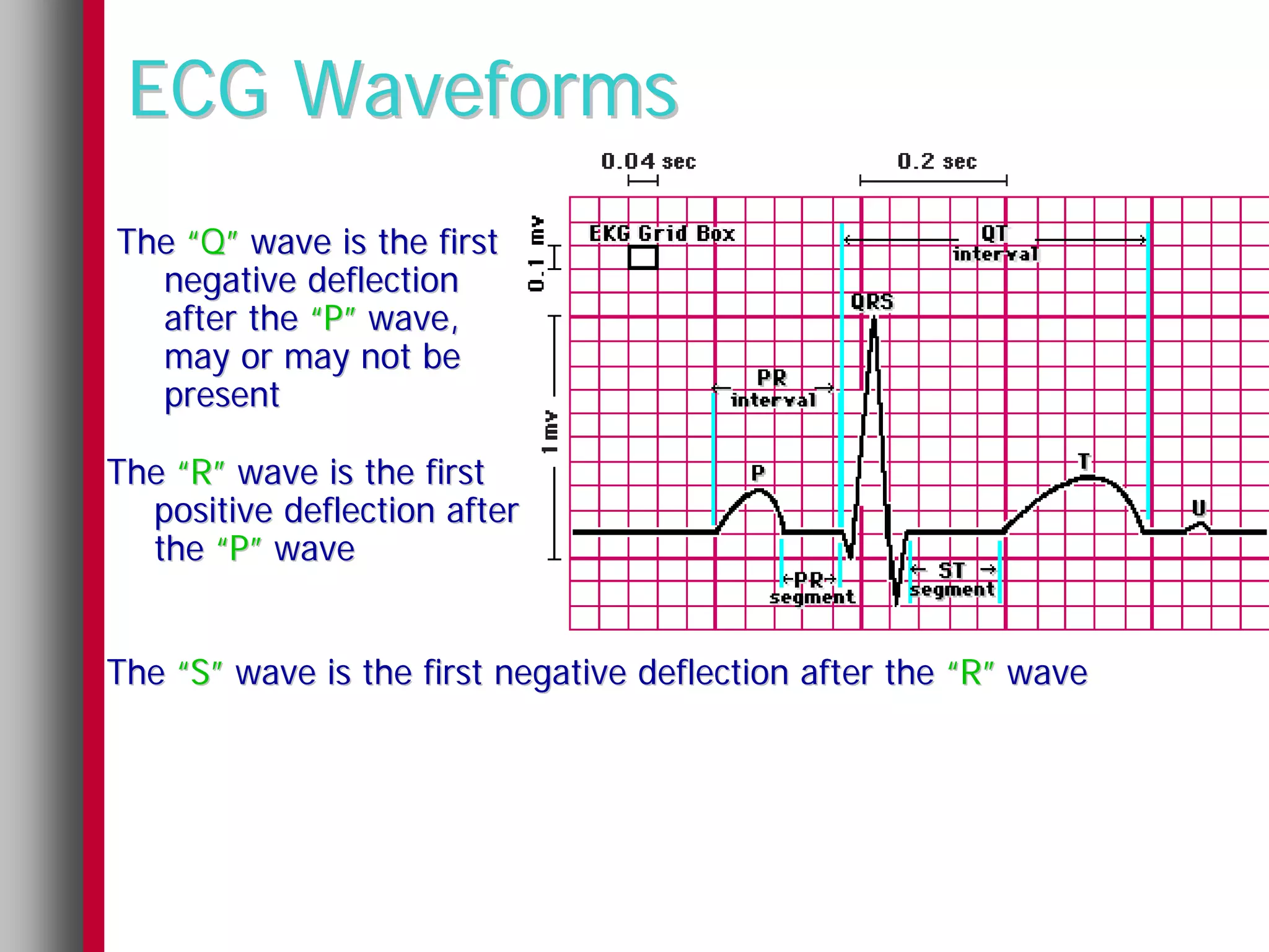 ECG Waveforms
The “Q” wave is the first
  negative deflection
  after the “P” wave,
  may or may not be
  present

The “R” wave is the first
  positive deflection after
  the “P” wave


The “S” wave is the first negative deflection after the “R” wave
 