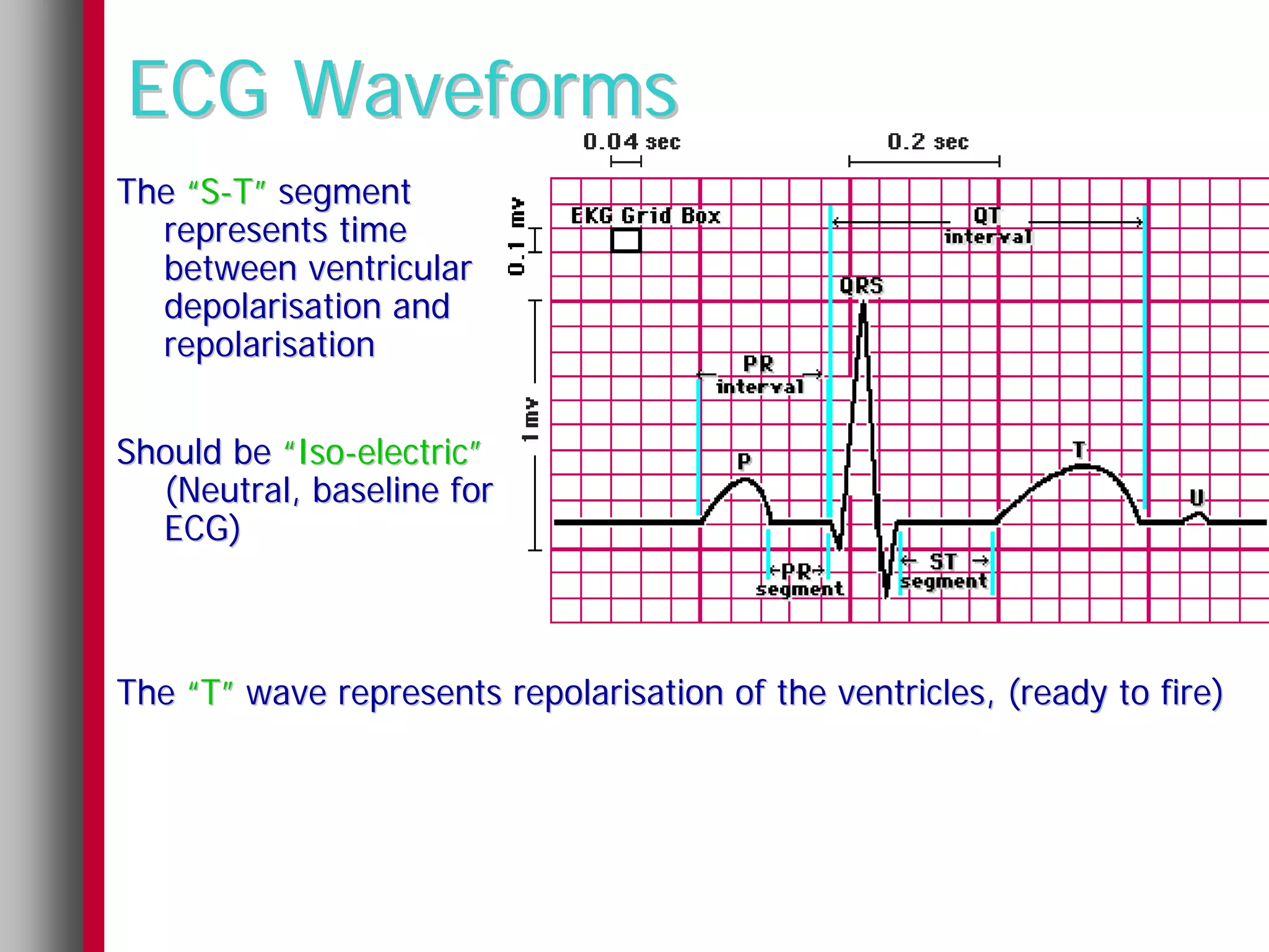ECG Waveforms
The “S-T” segment
  represents time
  between ventricular
  depolarisation and
  repolarisation


Should be “Iso-electric”
  (Neutral, baseline for
  ECG)



The “T” wave represents repolarisation of the ventricles, (ready to fire)
 
