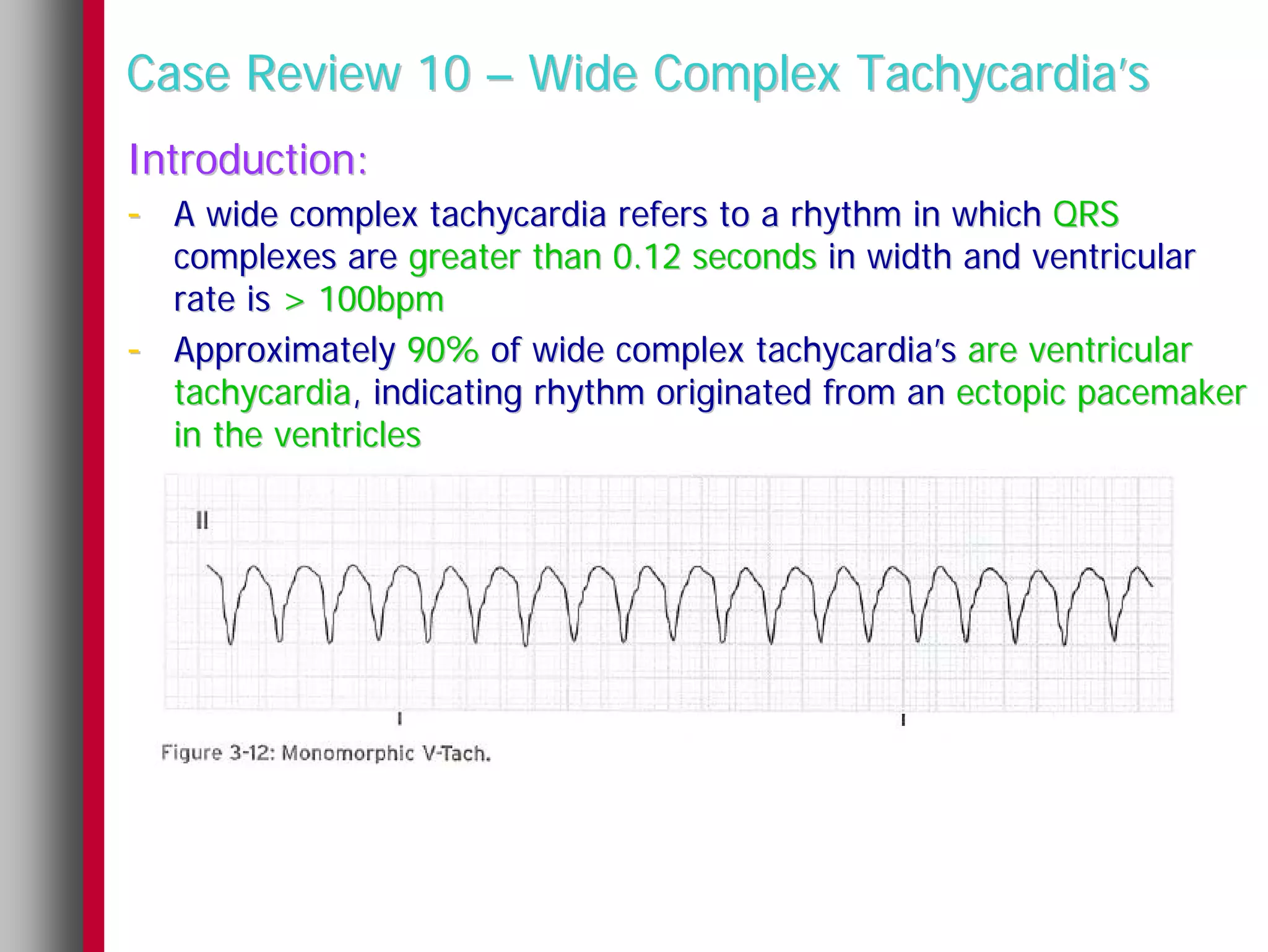 Case Review 10 – Wide Complex Tachycardia’s
Introduction:
- A wide complex tachycardia refers to a rhythm in which QRS
    complexes are greater than 0.12 seconds in width and ventricular
    rate is > 100bpm
-   Approximately 90% of wide complex tachycardia’s are ventricular
    tachycardia, indicating rhythm originated from an ectopic pacemaker
    in the ventricles
 