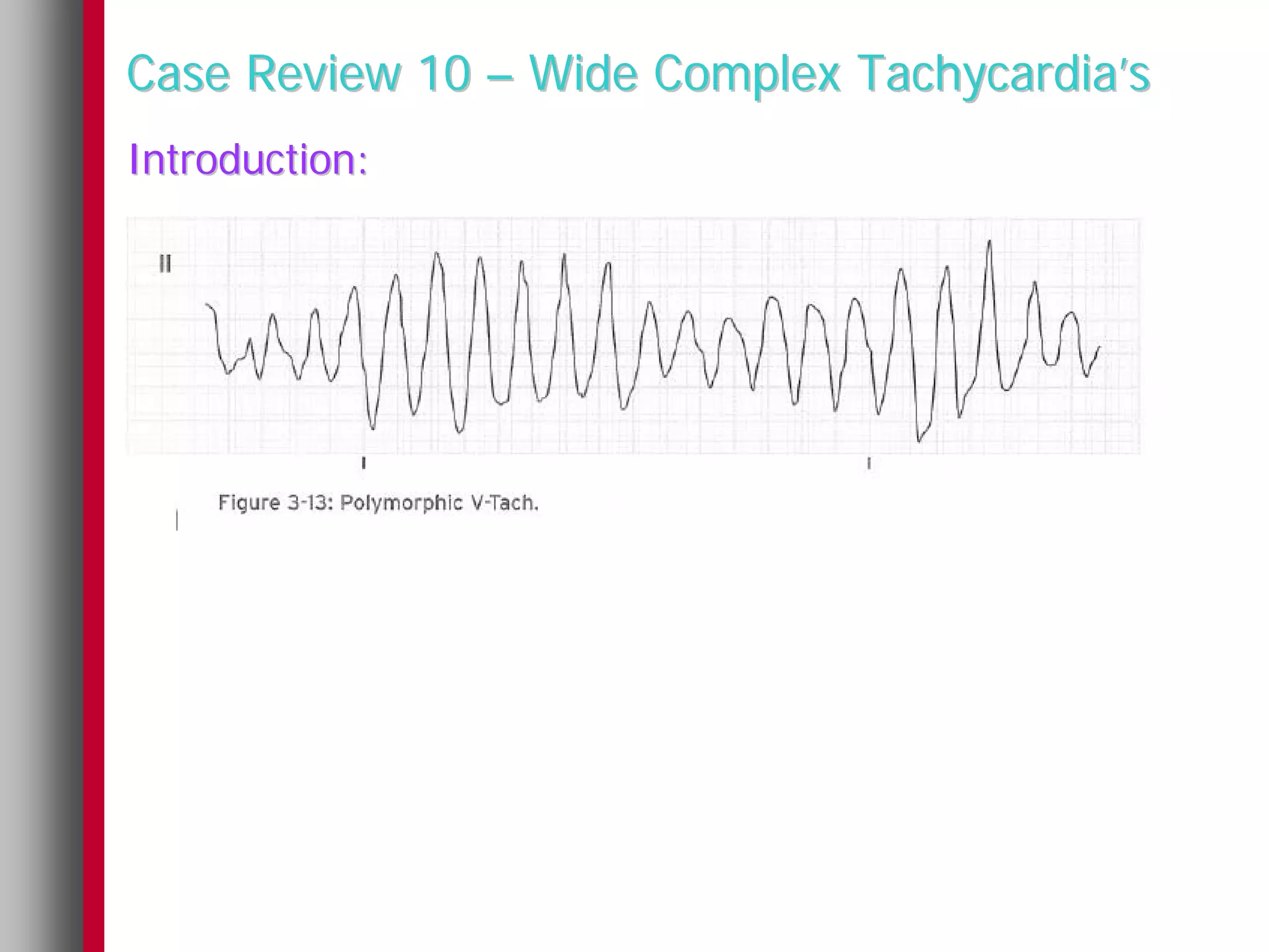 Case Review 10 – Wide Complex Tachycardia’s
Introduction:
 