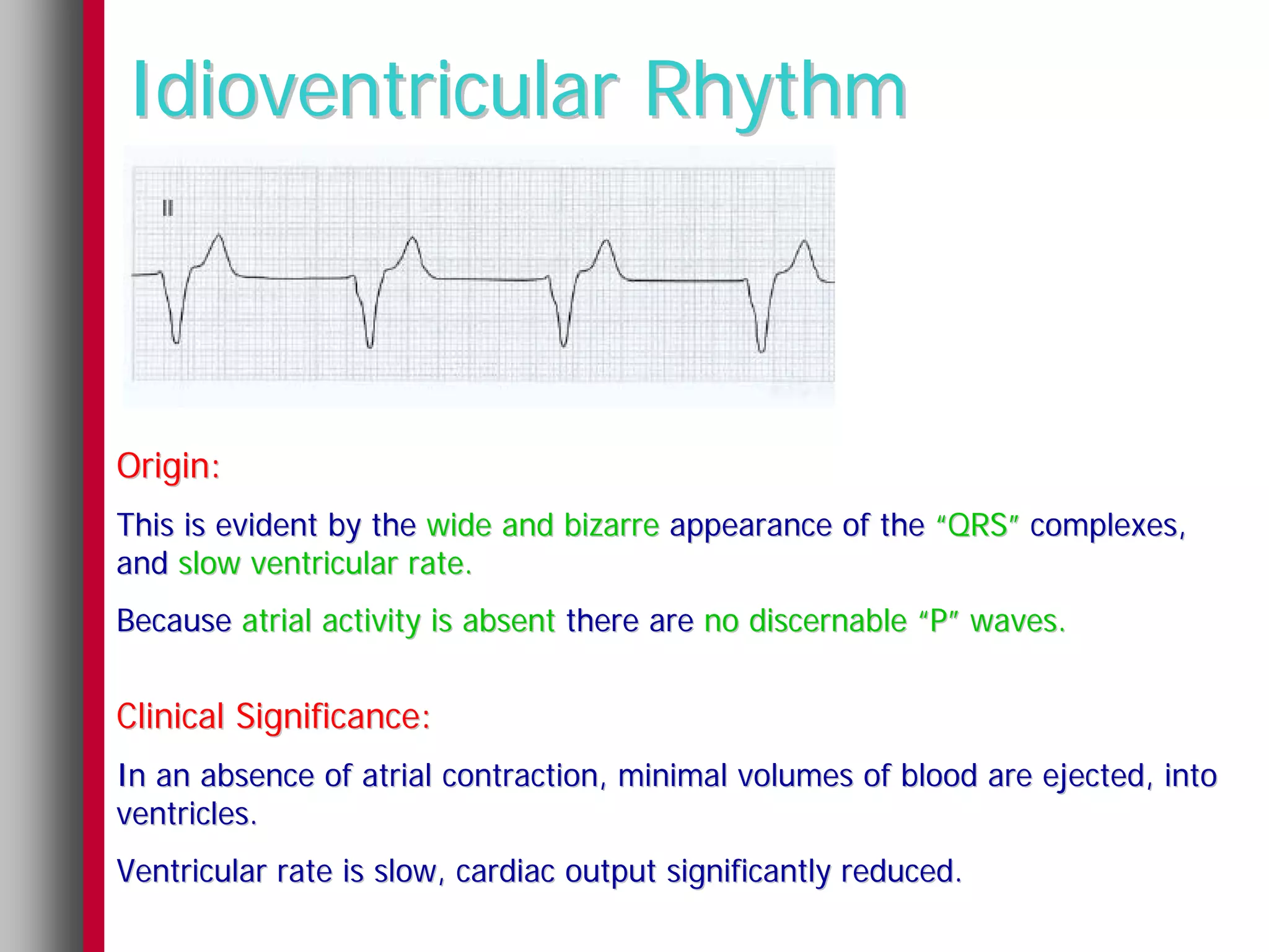 Idioventricular Rhythm



Origin:
This is evident by the wide and bizarre appearance of the “QRS” complexes,
and slow ventricular rate.
Because atrial activity is absent there are no discernable “P” waves.


Clinical Significance:
In an absence of atrial contraction, minimal volumes of blood are ejected, into
ventricles.
Ventricular rate is slow, cardiac output significantly reduced.
 