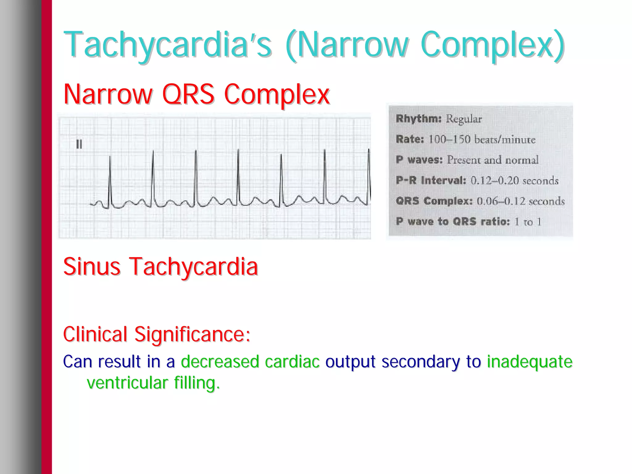 Tachycardia’s (Narrow Complex)
Narrow QRS Complex




Sinus Tachycardia

Clinical Significance:
Can result in a decreased cardiac output secondary to inadequate
  ventricular filling.
 