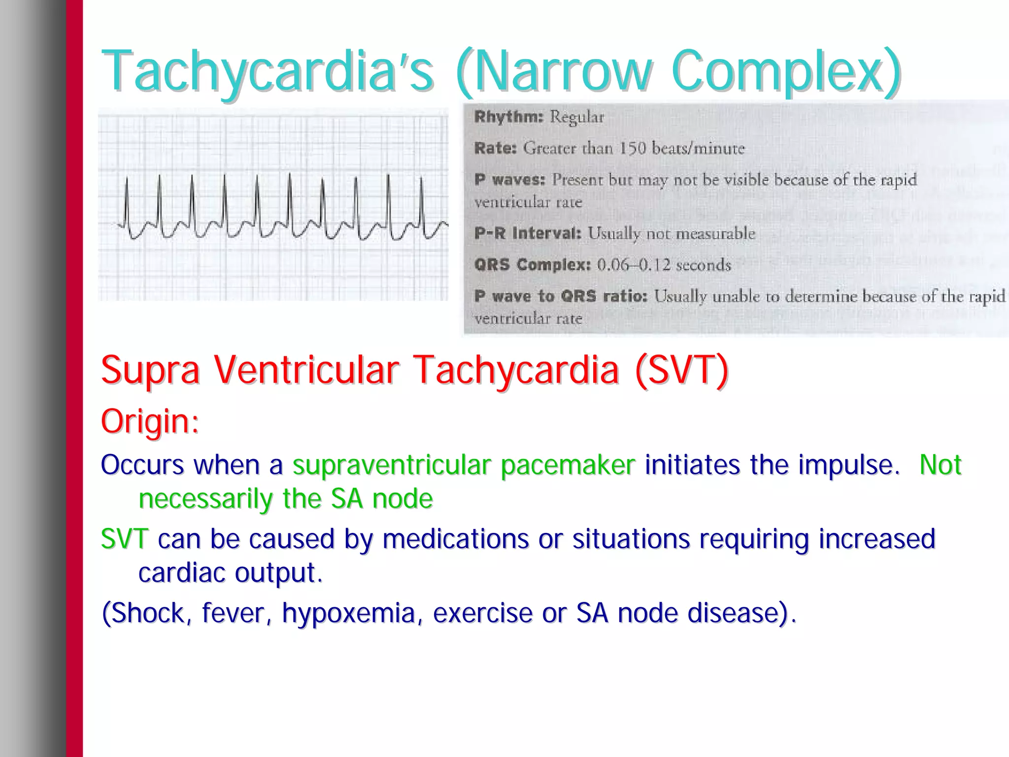Tachycardia’s (Narrow Complex)




Supra Ventricular Tachycardia (SVT)
Origin:
Occurs when a supraventricular pacemaker initiates the impulse. Not
   necessarily the SA node
SVT can be caused by medications or situations requiring increased
   cardiac output.
(Shock, fever, hypoxemia, exercise or SA node disease).
 