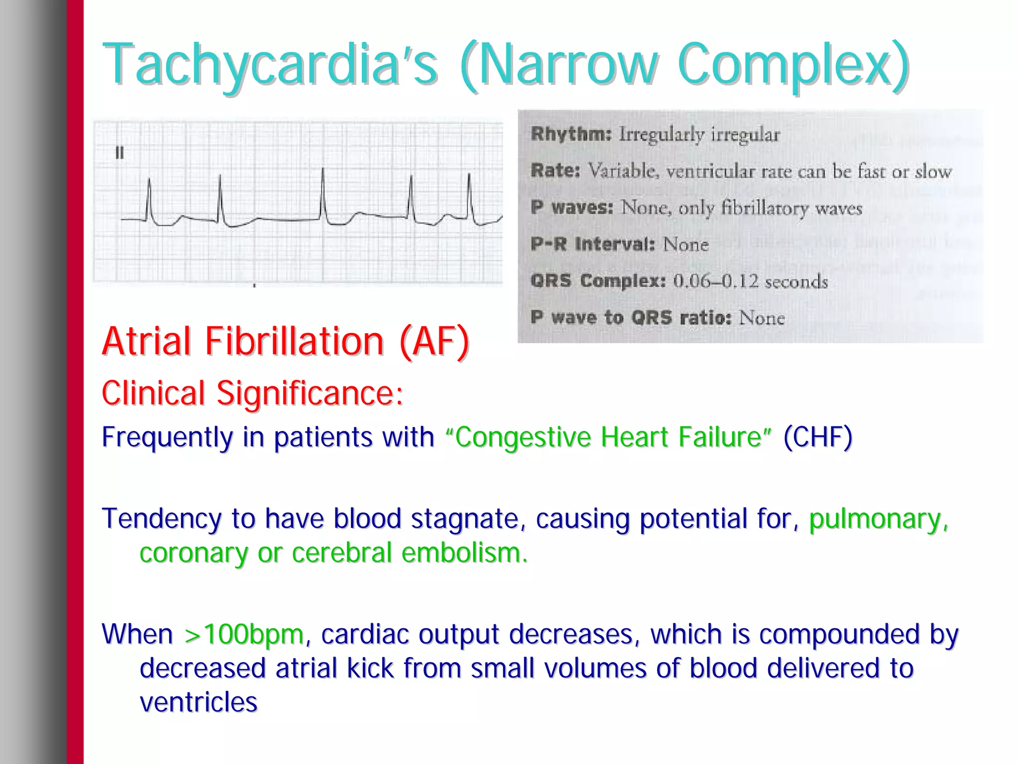 Tachycardia’s (Narrow Complex)



Atrial Fibrillation (AF)
Clinical Significance:
Frequently in patients with “Congestive Heart Failure” (CHF)

Tendency to have blood stagnate, causing potential for, pulmonary,
  coronary or cerebral embolism.

When >100bpm, cardiac output decreases, which is compounded by
  decreased atrial kick from small volumes of blood delivered to
  ventricles
 