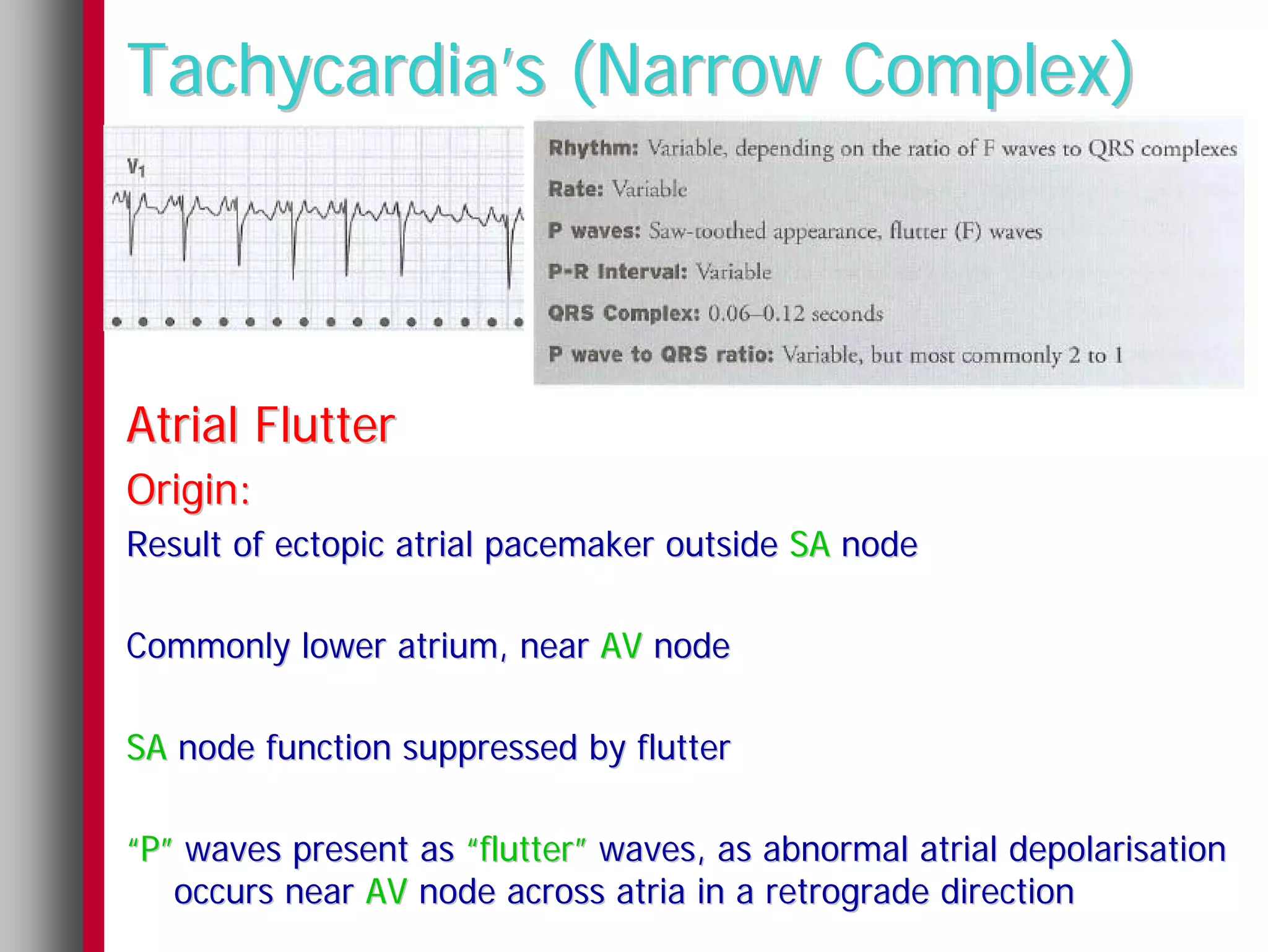 Tachycardia’s (Narrow Complex)



Atrial Flutter
Origin:
Result of ectopic atrial pacemaker outside SA node

Commonly lower atrium, near AV node

SA node function suppressed by flutter

“P” waves present as “flutter” waves, as abnormal atrial depolarisation
   occurs near AV node across atria in a retrograde direction
 