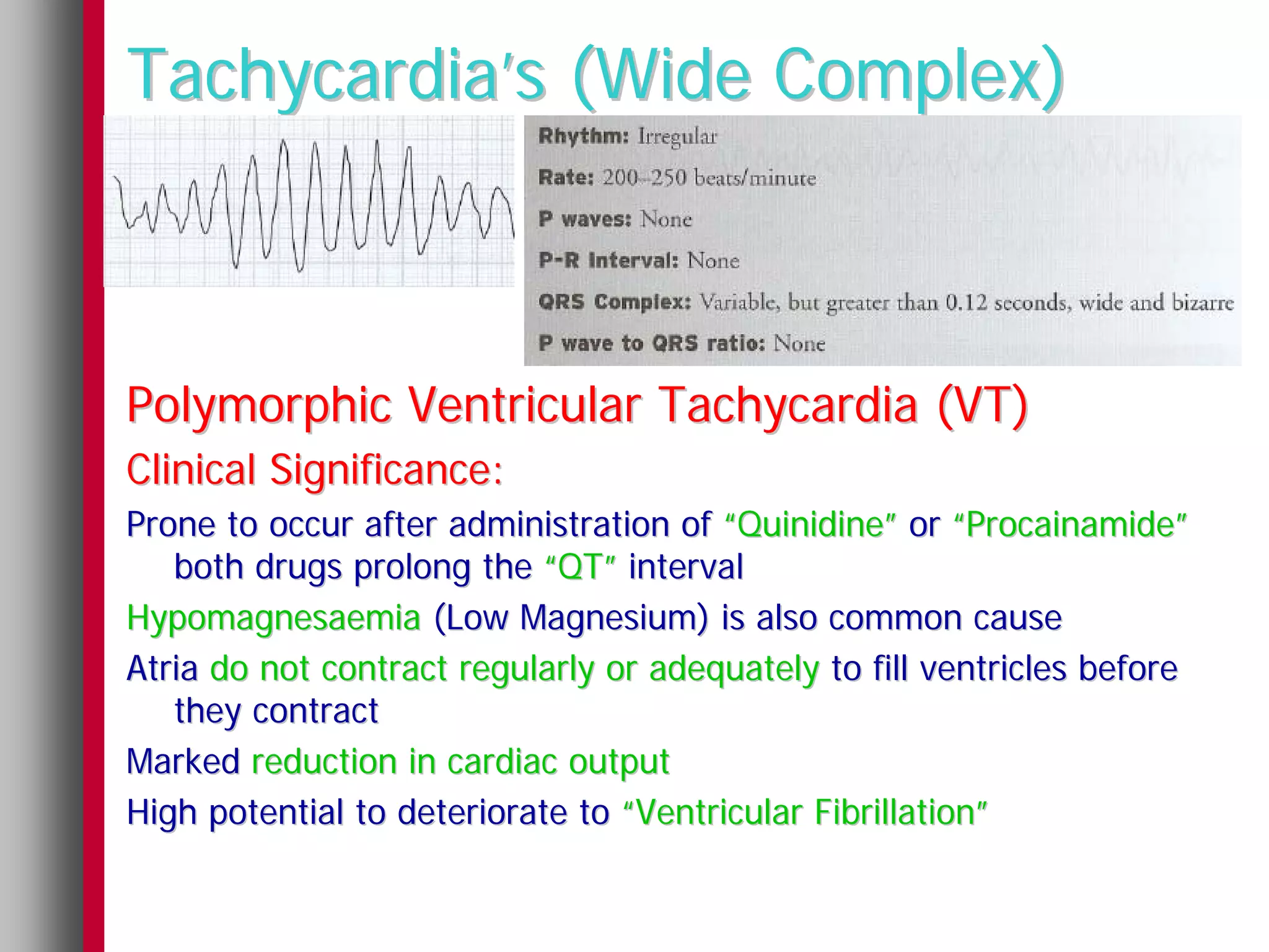 Tachycardia’s (Wide Complex)



Polymorphic Ventricular Tachycardia (VT)
Clinical Significance:
Prone to occur after administration of “Quinidine” or “Procainamide”
   both drugs prolong the “QT” interval
Hypomagnesaemia (Low Magnesium) is also common cause
Atria do not contract regularly or adequately to fill ventricles before
   they contract
Marked reduction in cardiac output
High potential to deteriorate to “Ventricular Fibrillation”
 