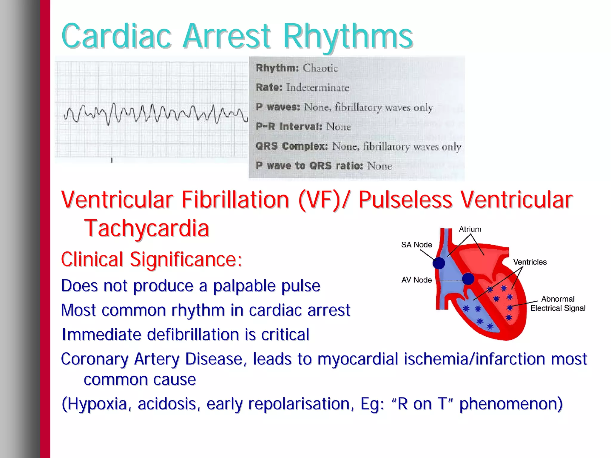Cardiac Arrest Rhythms



Ventricular Fibrillation (VF)/ Pulseless Ventricular
  Tachycardia
Clinical Significance:
Does not produce a palpable pulse
Most common rhythm in cardiac arrest
Immediate defibrillation is critical
Coronary Artery Disease, leads to myocardial ischemia/infarction most
   common cause
(Hypoxia, acidosis, early repolarisation, Eg: “R on T” phenomenon)
 