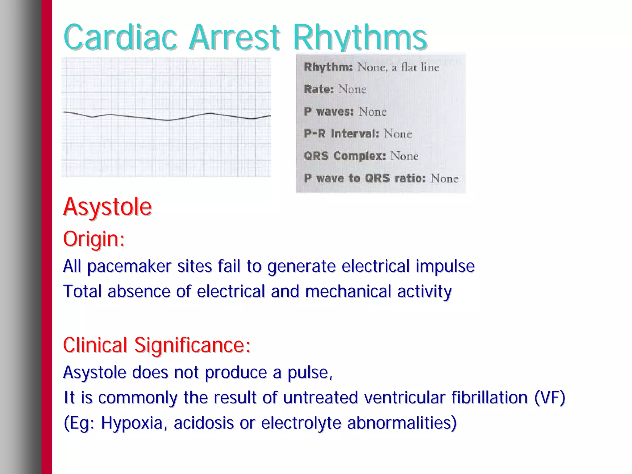 Cardiac Arrest Rhythms



Asystole
Origin:
All pacemaker sites fail to generate electrical impulse
Total absence of electrical and mechanical activity


Clinical Significance:
Asystole does not produce a pulse,
It is commonly the result of untreated ventricular fibrillation (VF)
(Eg: Hypoxia, acidosis or electrolyte abnormalities)
 