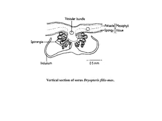 Vertical section of sorus Dryopteris filix-mas.
 